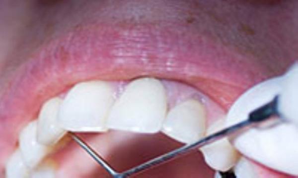 اصول حفظ دندان ها در سنین بالا