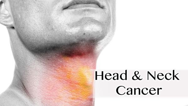 تشخیص به موقع سرطان سر و گردن