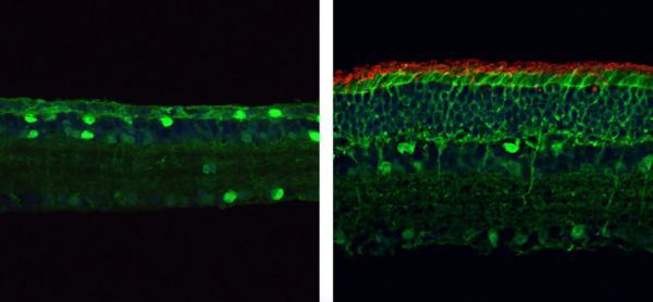 بازسازی بینایی در موش های مبتلا به رتینیت پیگمنتوزا با استفاده از شیوه CRISPR